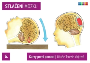 Ilustrace pro výuku první pomoci